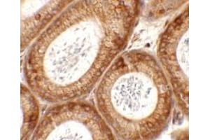 Immunohistochemistry of SPATA6 in mouse testis tissue with SPATA6 antibody at 2. (SPATA6 anticorps  (C-Term))