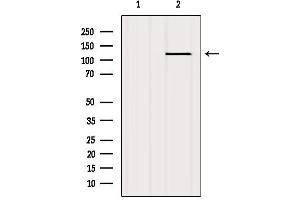 Western blot analysis of extracts from Mouse lung, using PKD1/PKC μ Antibody. (PKC mu anticorps  (Internal Region))