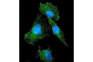 IF analysis of FLT1 using anti-FLT1 antibody (ABIN7601014).