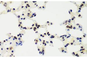 Immunohistochemistry of paraffin-embedded Rat lung using RNF2 Polyclonal Antibody at dilution of 1:100 (40x lens).