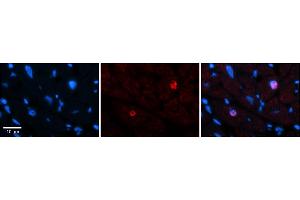 Rabbit Anti-LBX1 Antibody    Formalin Fixed Paraffin Embedded Tissue: Human Adult heart  Observed Staining: Nuclear (rare) Primary Antibody Concentration: 1:600 Secondary Antibody: Donkey anti-Rabbit-Cy2/3 Secondary Antibody Concentration: 1:200 Magnification: 20X Exposure Time: 0. (Lbx1 anticorps  (N-Term))