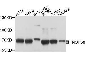Western blot analysis of extracts of various cells, using NOP58 antibody. (NOP58 anticorps)