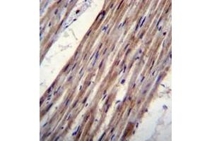 Immunohistochemistry analysis in formalin fixed and paraffin embedded human heart tissue reacted with KCNJ8 Antibody (N-term) followed which was peroxidase conjugated to the secondary antibody and followed by DAB staining. (KCNJ8 anticorps  (N-Term))