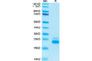 Human TRAIL R2 on Tris-Bis PAGE under reduced condition. (TNFRSF10B Protein (AA 56-182) (His-Avi Tag))