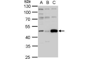 WB Image IDH1 antibody detects IDH1 protein by western blot analysis.