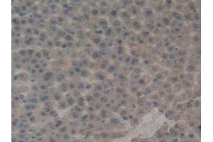 IHC-P analysis of Rat Liver Tissue, with DAB staining. (PAI1 anticorps  (AA 24-402))
