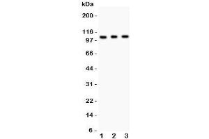 Western blot testing of GRIK1 antibody and Lane 1:  mouse brain;  2: mouse brain;  3: human SHG-44 (glioma) lysate. (GRIK1 anticorps  (AA 271-450))