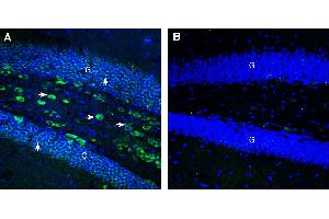 Expression of CCKBR in mouse hippocampus. (CCKBR anticorps  (Extracellular))
