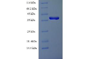 SDS-PAGE (SDS) image for Colony Stimulating Factor 2 (Granulocyte-Macrophage) (CSF2) (AA 18-144) protein (GST tag) (ABIN5709337)