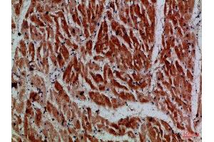 Immunohistochemical analysis of paraffin-embedded Human-heart, antibody was diluted at 1:100 (MYH6 anticorps)