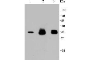 Lane 1: HeLa Cell lysates, Lane 2: PC12 Cell lysates, Lane 3: SH-SY5Y Cell lysates,probed with Cyclin D1 (2H4) Monoclonal Antibody  at 1:1000 overnight at 4˚C. (Cyclin D1 anticorps)