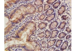 Formalin-fixed and paraffin embedded rat colon labeled with Rabbit Rabbit Anti-CISD1 Polyclonal Antibody, Unconjugated (ABIN2173059) at 1:200 followed by conjugation to the secondary antibody and DAB staining