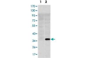 Western blot analysis using SLC22A1 monoclonal antobody, clone 2C5  against HEK293 (1) and SLC22A1-hIgGFc transfected HEK293 (2) cell lysate. (SLC22A1 anticorps)