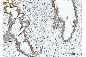 IHC analysis of BCKDK using anti-BCKDK antibody (ABIN7601470). (BCKDK anticorps  (AA 36-316))