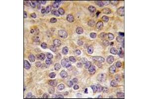 Image no. 2 for anti-Protein Arginine Methyltransferase 3 (PRMT3) (N-Term) antibody (ABIN356524) (PRMT3 anticorps  (N-Term))