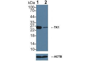 Knockout Varification: ;Lane 1: Wild-type 293T cell lysate; ;Lane 2: TK1 knockout 293T cell lysate; ;Predicted MW: 25kDaa ;Observed MW: 26kDa;Primary Ab: 3µg/ml Rabbit Anti-Human TK1 Antibody;Second Ab: 0. (TK1 anticorps  (AA 2-234))