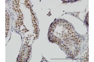 Immunoperoxidase of monoclonal antibody to RNF141 on formalin-fixed paraffin-embedded human testis.