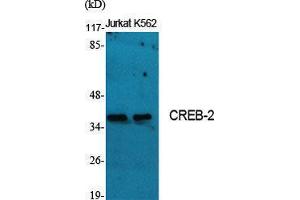 Western Blotting (WB) image for anti-Activating Transcription Factor 4 (Tax-Responsive Enhancer Element B67) (ATF4) (Ser159) antibody (ABIN6281746)