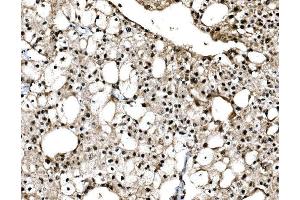 IHC analysis of C-Jun/JUN using anti-C-Jun/JUN antibody (ABIN7601421).