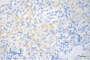 anti-Protein Kinase C Substrate 80K-H (PRKCSH) antibody