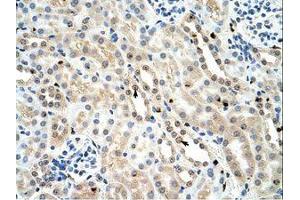 Image no. 1 for anti-Forkhead Box K1 (Foxk1) (AA 501-550) antibody (ABIN202818)