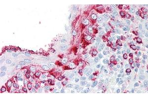 Detection of KLK8 in Human Tonsil Tissue using Polyclonal Antibody to Kallikrein 8 (KLK8) (Kallikrein 8 anticorps  (AA 29-260))