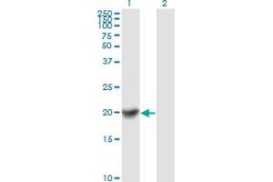 Western Blot analysis of COMMD1 expression in transfected 293T cell line by COMMD1 monoclonal antibody (M01), clone 2A12.