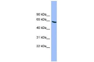 WB Suggested Anti-DYRK3 Antibody Titration: 0.