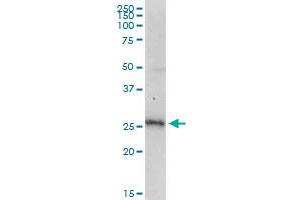 SMUG1 monoclonal antibody (M07), clone 4D5.