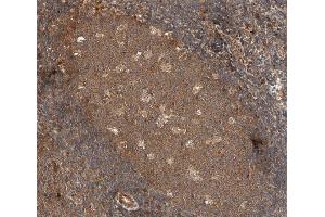 ABIN6266484 at 1/100 staining human Lymphoma tissue sections by IHC-P. (IL2 Receptor beta anticorps  (Internal Region))