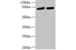 Western blot All lanes: DDHD2 antibody at 10 μg/mL Lane 1: K562 whole cell lysate Lane 2: U251 whole cell lysate Secondary Goat polyclonal to rabbit IgG at 1/10000 dilution Predicted band size: 82, 38 kDa Observed band size: 82 kDa (DDHD2 anticorps  (AA 361-650))