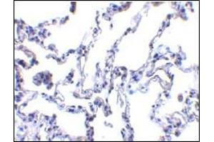 AP30640PU-N p53R2 antibody staining of Human lung tissue by Immunohistochemistry at 1 μg/ml. (RRM2B anticorps  (N-Term))