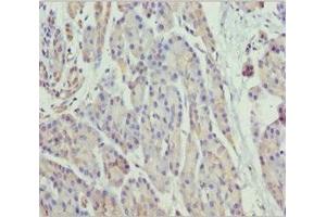 Immunohistochemistry of paraffin-embedded human pancreatic tissue using ABIN7160787 at dilution of 1:100 (SCYL1 anticorps  (AA 460-740))