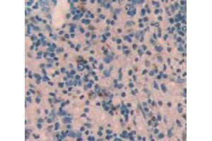 Used in DAB staining on fromalin fixed paraffin- embedded Kidney tissue (STING/TMEM173 anticorps  (AA 160-371))