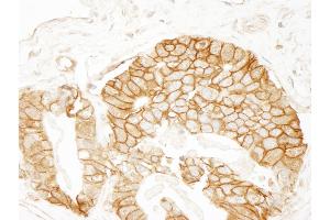 Immunohistochemistry (IHC) image for anti-Catenin, beta (CATNB) (AA 760-781) antibody (ABIN7448432)