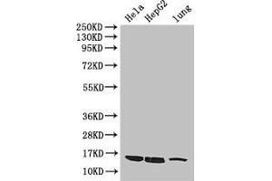 Western Blot Positive WB detected in: Hela whole cell lysate, HepG2 whole cell lysate, Mouse lung tissue All lanes: CISD2 antibody at 3 μg/mL Secondary Goat polyclonal to rabbit IgG at 1/50000 dilution Predicted band size: 16 kDa Observed band size: 16 kDa (CISD2 anticorps  (AA 61-135))