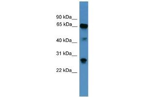WB Suggested Anti-CANX Antibody Titration: 1. (Calnexin anticorps  (Middle Region))