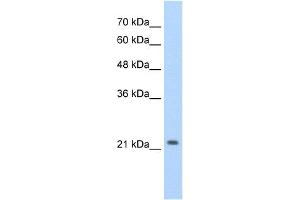 WB Suggested Anti-DLX2 Antibody Titration:  2. (DLX2 anticorps  (C-Term))