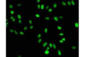 Immunofluorescence staining of Hela cells with ABIN7127305 at 1:50,counter-stained with DAPI. (Recombinant HIST1H4A anticorps  (meLys16))