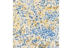 Immunohistochemistry analysis of paraffin embedded rat spleen using HOMER3 (ABIN7074257) at dilution of 1: 2100