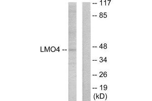 Western Blotting (WB) image for anti-LIM Domain Only 4 (LMO4) (C-Term) antibody (ABIN1849492) (LMO4 anticorps  (C-Term))