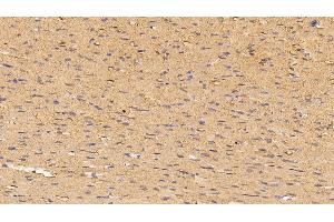 Detection of MYO in Rat Cardiac Muscle Tissue using Polyclonal Antibody to Myoglobin (MYO)