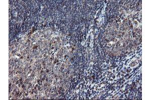 Image no. 14 for anti-Diphthamide Biosynthesis Protein 2 (DPH2) antibody (ABIN1497893) (DPH2 anticorps)