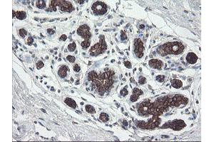 Immunohistochemical staining of paraffin-embedded Human breast tissue using anti-DPH2 mouse monoclonal antibody. (DPH2 anticorps)