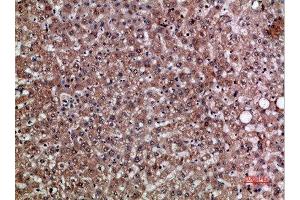 Immunohistochemical analysis of paraffin-embedded human-liver, antibody was diluted at 1:200