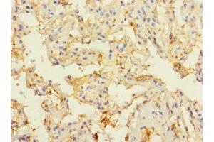 Immunohistochemistry of paraffin-embedded human lung tissue using ABIN7148571 at dilution of 1:100 (CIR1 anticorps  (AA 1-160))