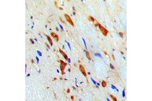 Immunohistochemical analysis of STAT1 staining in human brain formalin fixed paraffin embedded tissue section.