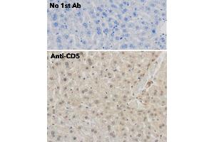Immunohistochemistry (IHC) image for anti-CD5 (CD5) (AA 105-210) antibody (ABIN7272988) (CD5 anticorps  (AA 105-210))