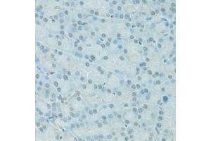 Immunohistochemistry of paraffin-embedded rat pancreas using PDC antibody. (Phosducin anticorps)