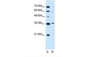 Image no. 2 for anti-Presenilin Associated, Rhomboid-Like (PARL) (AA 97-146) antibody (ABIN6738135) (PARL anticorps  (AA 97-146))